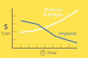 What do dental implants cost?